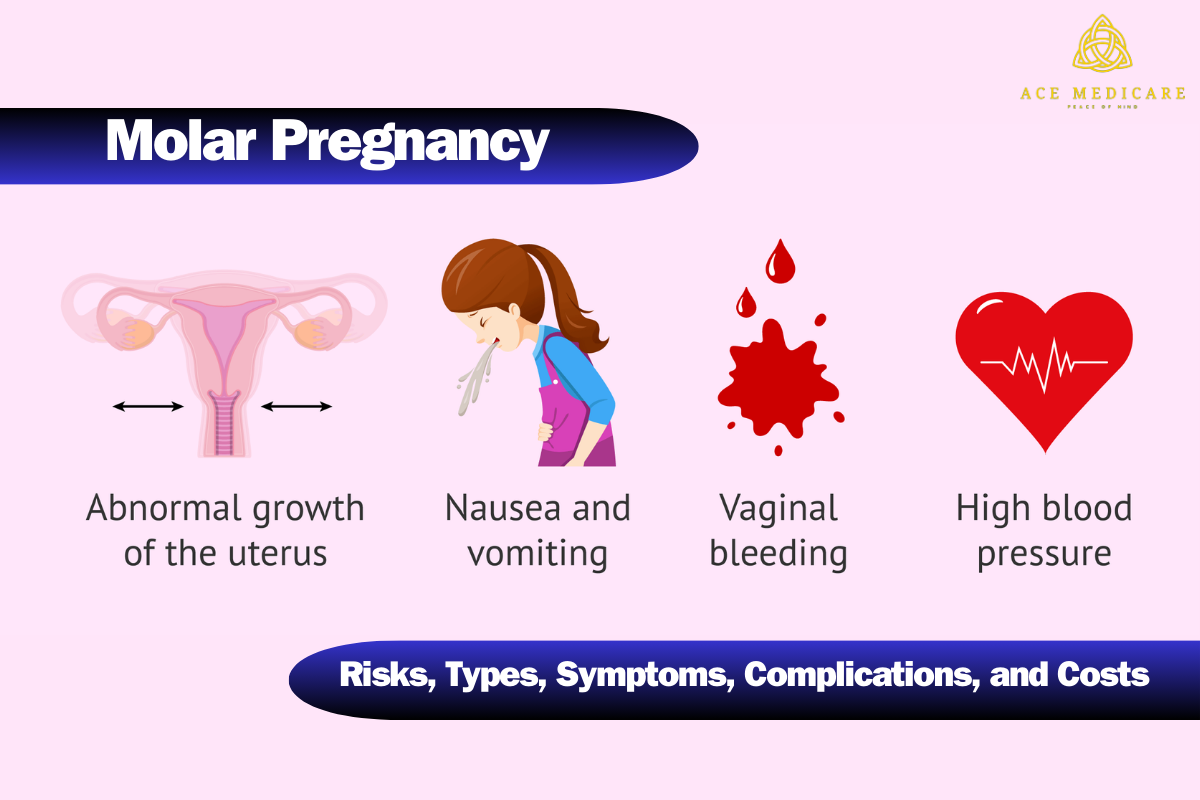 Molar Pregnancy and Its Effects on Future Pregnancies: Understanding the Risks, Types, Symptoms, Complications, and Costs